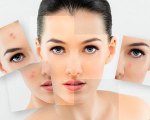 Пять домашних средств, которые могут навредить коже лица