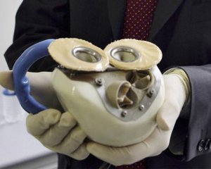 Американца выписали из больницы с искусственным сердцем