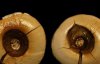 Давні зубні пломби знайшли археологи