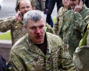 "Не цінують й всім начхати": розповіли про проблеми ветеранів АТО