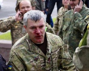 &quot;Не цінують й всім начхати&quot;: розповіли про проблеми ветеранів АТО