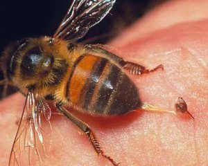 6-річного хлопчика вбив укус бджоли