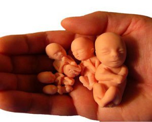 ВООЗ оприлюднила жахливу статистику нелегальних абортів