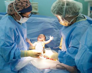Лікарі навчилися робити кесарів розтин без швів