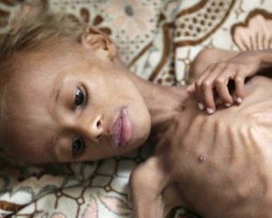 50 тыс. детей умрут из-за войны до конца года