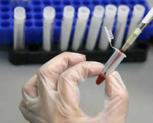 Гепатит в Харьковской области: количество больных резко выросло