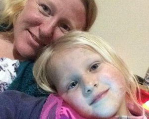 2-річна дівчинка проковтнула аккумулятор