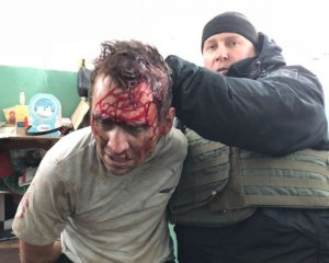 Силовики взяли штурмом відділення пошти, - закривавленого зловмисника затримали