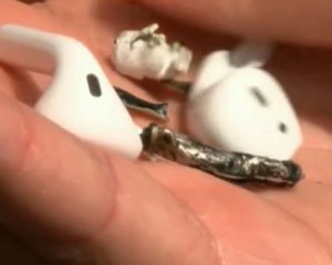 Навушники AirPods загорілися у вусі чоловіка.