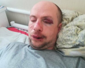 Под Киевом жестоко избили ветерана АТО