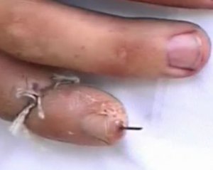 Чоловік відрізав палець вагітній дружині