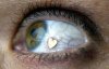 Вживляють в очі металеві прикраси: США шокували новою модою