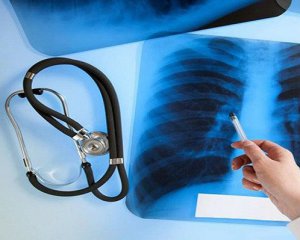 В Украине - эпидемия туберкулеза
