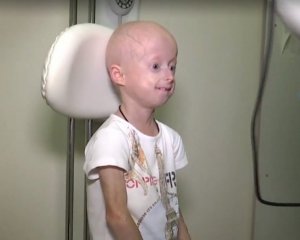 Провели уникальную операцию семилетней девочке, которая раньше постарела