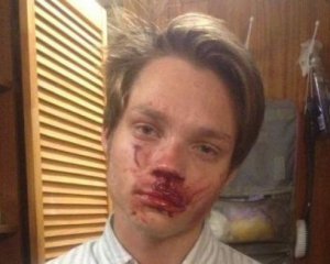 "Благав не дзвонити у поліцію" - підлітки побили школяра