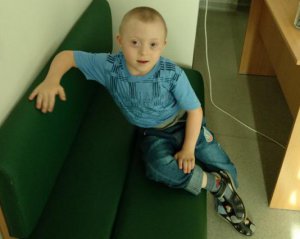 Хлопчику з синдромом Дауна терміново потрібна операція на серці