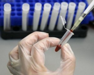 9 школярів захворіли на гепатит С на Одещині