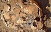 Выкопали нашли череп человека, прооперированного 4 тыс. лет назад