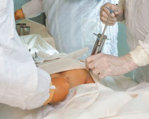 В Україні з'явиться реєстр потенційних донорів