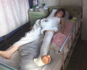 Знеболювальне дали на 4-й день: українська модель потрапила в аварію у Китаї