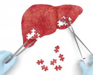 7 ознак того, що слід обстежити печінку