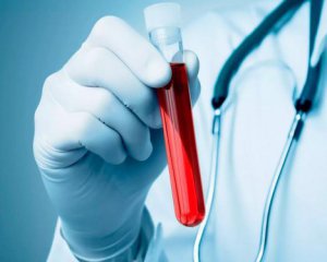 Назвали кількість ВІЛ-інфікованих українців