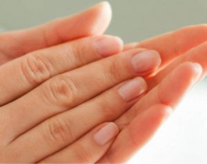 Діагноз за руками: що нігті розкажуть про стан здоров&#039;я