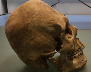 Археологи наткнулись на череп странной формы