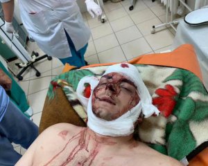 Избиение Семенихина: в Конотоп  отправили усиленную группу Нацполиции