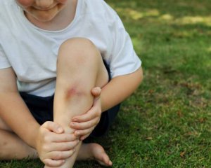 Мальчик подцепил смертельную инфекцию из-за царапин на коленях