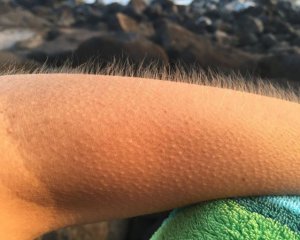 У людському тілі виявили новий орган