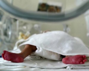 Умерли сиамские близнецы, которые родились в Черновцах