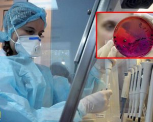 Дитина заразилася сибірською виразкою - проводять перевірку