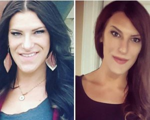 Зміни до невпізнання: рідкісна хвороба спотворила дівчину