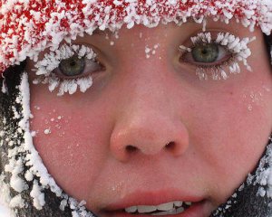 Что такое аллергия на холод