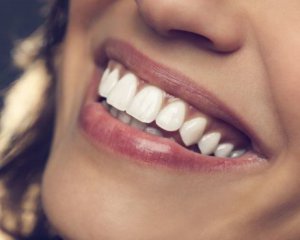 Як доглядати за зубами з вінірами