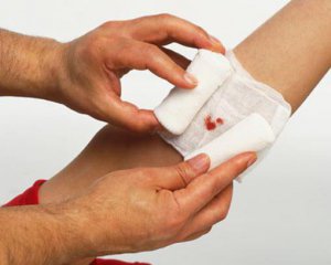 Як правильно зупиняти кровотечу: найчастіші помилки