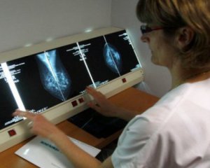 Штучний інтелект виявляє рак молочної залози краще за лікарів