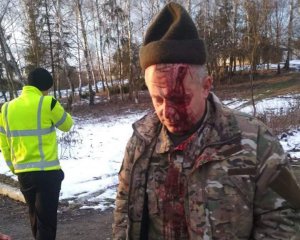 Ветеранові АТО молотком розтрощили голову