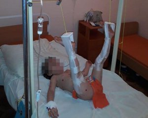 Сломанные ноги и шок: ребенка в больнице привалило дверью