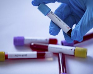 МОЗ закупило велику партію експрес-тестів на коронавірус