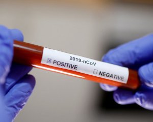 4 из 7 инфицированных коронавирусом заразились внутри Украины