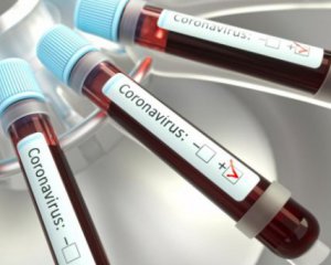 Розробили швидкий тест на наявність COVID-19