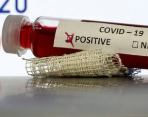 У Житомирі – перший інфікований коронавірусом