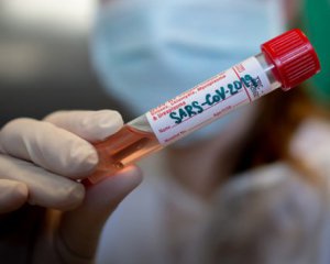 В Украине разработали тесты для выявления коронавируса