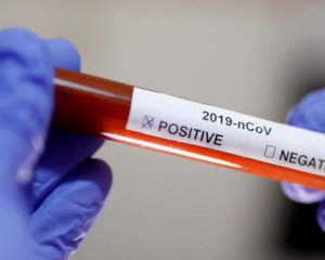 У Києві виявили 7 нових випадків зараження короновірусом