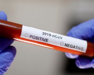 В Хмельницкой области подтвердили первый случай коронавируса