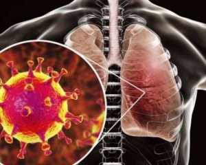 В тривимірному відео показали інфіковані небезпечним вірусом легені