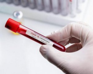 У пологовому померла друга жінка з коронавірусом