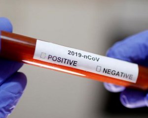 В Україні затвердили єдиний протокол лікування хворих на коронавірус